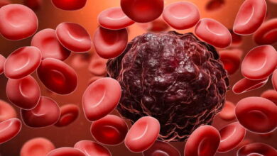 Blood Cancer के उपचार के लिए अस्थि मज्जा प्रत्यारोपण क्या है?