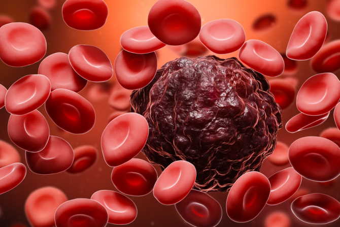 Blood Cancer के उपचार के लिए अस्थि मज्जा प्रत्यारोपण क्या है?