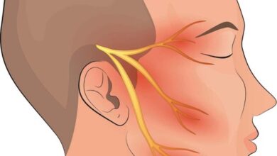 Trigeminal Neuralgia: लक्षण, उपचार और कारण जानिये