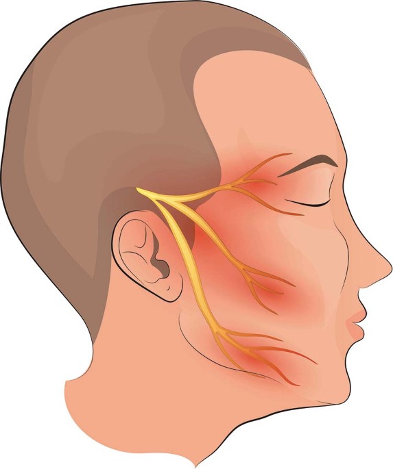 Trigeminal Neuralgia: लक्षण, उपचार और कारण जानिये