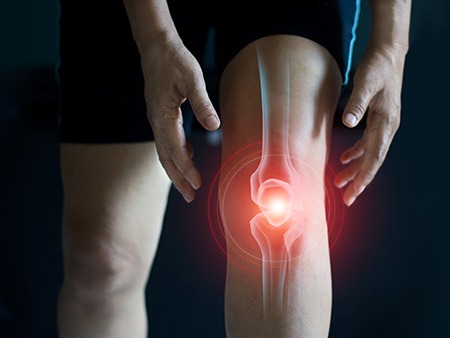 Arthritis: प्रतिकूल परिणामों को रोकने के लिए गठिया के शुरुआती लक्षणों को पहचानना