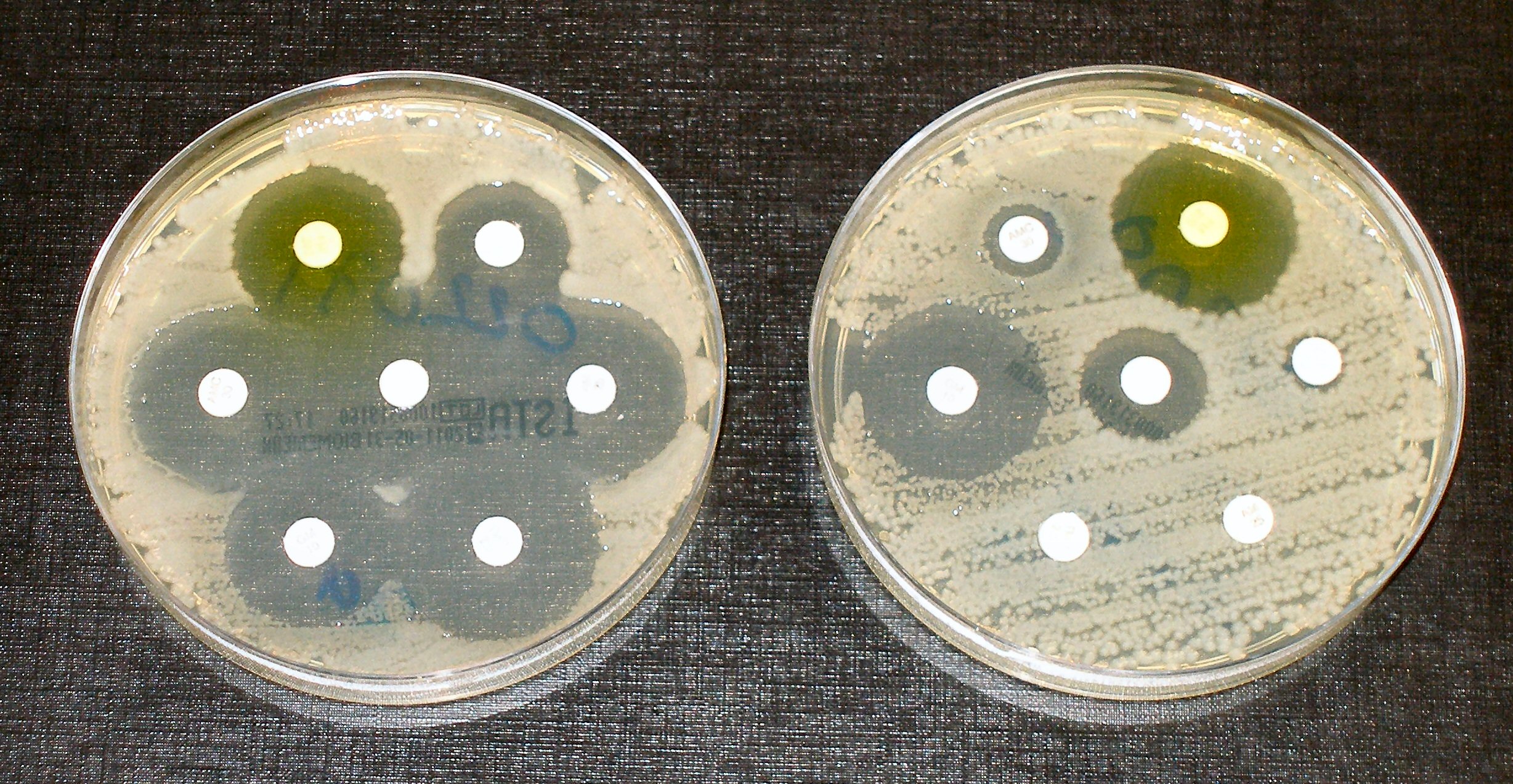 Antimicrobial resistance से निपटने और रोग निगरानी को बेहतर बनाने के लिए उठाए गए कदम