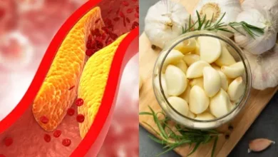 Garlic In Cholesterol: यूरिक एसिड और उच्च कोलेस्ट्रॉल के लिए कच्चे लहसुन बहुत फायदेमंद है, जानें कब और कितना खाएं?