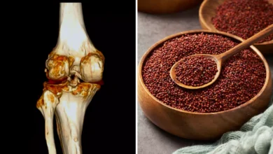 Ragi for bones: ये कैल्शियम से भरपूर सुपरफूड जोड़ों का दर्द दूर कर हड्डियों को फौलादी बना सकते हैं