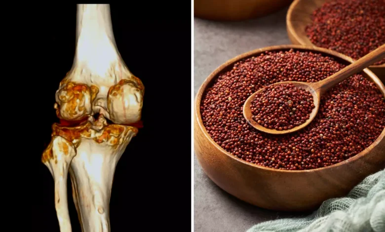 Ragi for bones: ये कैल्शियम से भरपूर सुपरफूड जोड़ों का दर्द दूर कर हड्डियों को फौलादी बना सकते हैं