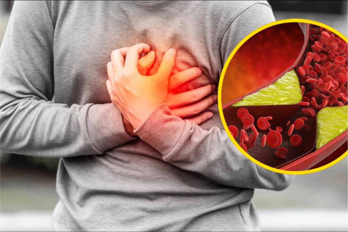 Bad Cholesterol Symptoms: शरीर में कोलेस्ट्रॉल का स्तर बढ़ने पर ये गंभीर संकेत दिखने लगते हैं, जो हार्ट अटैक का कारण बन सकते हैं, जानें नॉर्मल स्तर