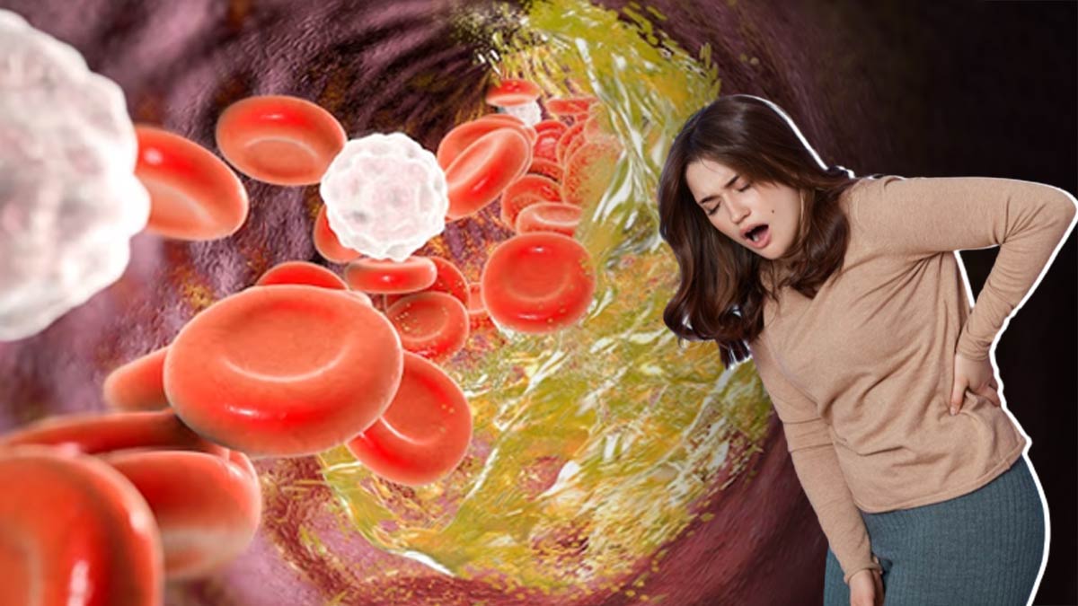 High Cholesterol Symptoms: शरीर के इन भागों में दर्द रहने लगा है, आपका कोलेस्ट्रॉल कहीं बढ़ तो नहीं गया?