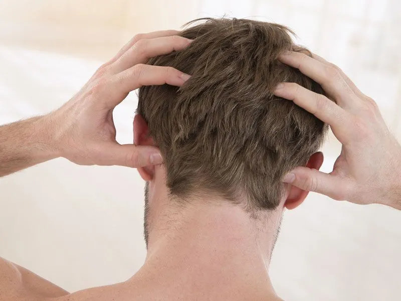 Hair Transplant Side Effects: हेयर ट्रांसप्लांट कराने के साइड इफेक्ट और किसे नहीं कराना चाहिए?