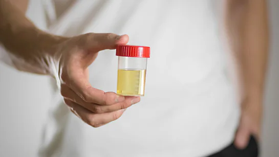 UTI Dehydration Symptoms: गर्मियों में यूरिन इन्फेक्शन के पहले लक्षणों से बचाव कैसे करें?