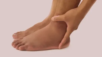 Legs Swelling Treatment: पैरों में सूजन का क्या कारण है?