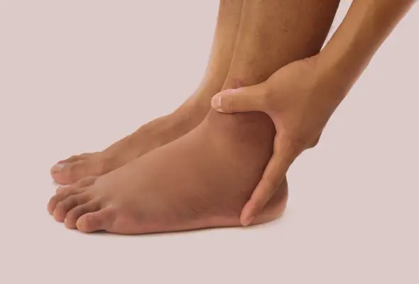 Legs Swelling Treatment: पैरों में सूजन का क्या कारण है?