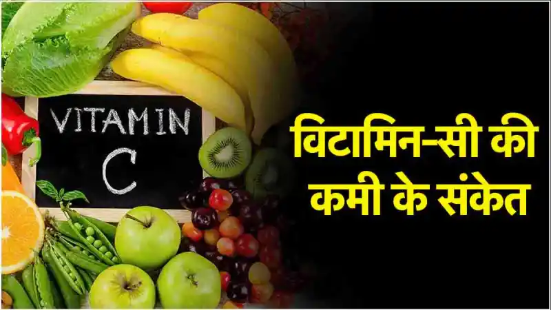 Vitamin C Deficiency: विटामिन की कमी से शरीर में खून की कमी हो जाती है, दिन भर थकान महसूस होती रहती है
